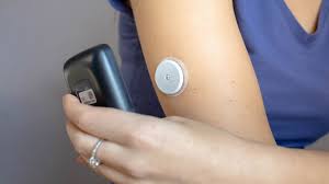 How CGM Sensor Patches Prevent Sensors from Falling Off During Activities